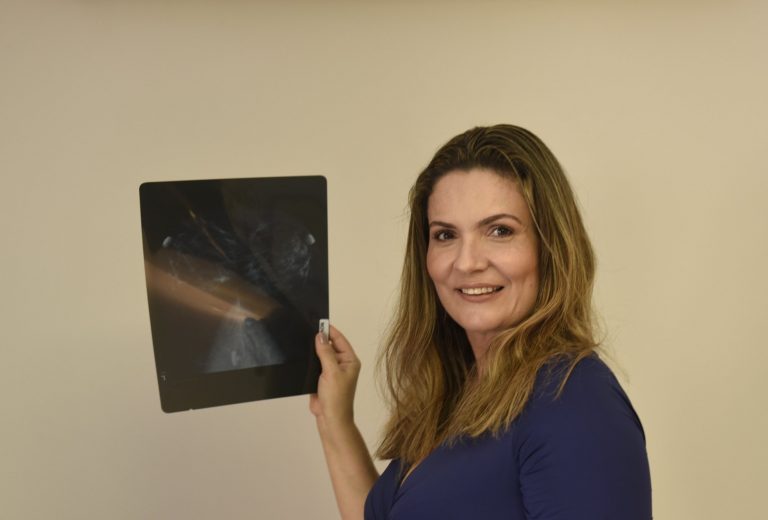Existe uma idade certa para começar a fazer mamografia?